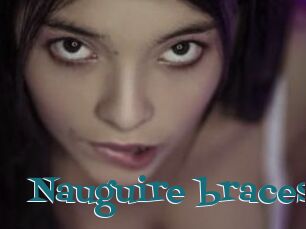 Nauguire_braces